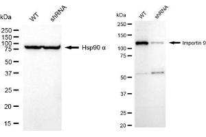 Western blotting analysis using Importin 9 antibody (ABIN7799024).