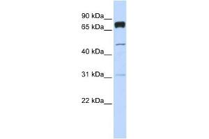 PLEKHA4 antibody used at 1 ug/ml to detect target protein. (PLEKHA4 antibody  (Middle Region))