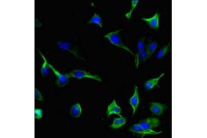 Immunofluorescent analysis of Hela cells using ABIN7156895 at dilution of 1:100 and Alexa Fluor 488-congugated AffiniPure Goat Anti-Rabbit IgG(H+L) (IL-33 antibody  (AA 123-276))