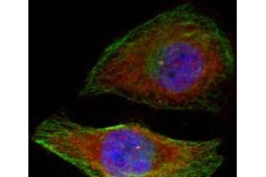 Immunofluorescence analysis of methanol-fixed HeLa cells showing cytoplasmic, nuclear staining using Phospho-MAPK3(T202) Polyclonal Antibody (ERK1 antibody  (pThr202))