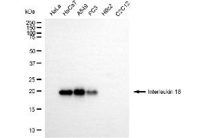 Western blotting analysis using interleukin 18 antibody (ABIN7799102).