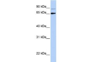 Host:  Rabbit  Target Name:  DGCR8  Sample Type:  Hela Cell lysates  Antibody Dilution:  1.