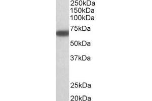 Western Blotting (WB) image for anti-Glutamate Decarboxylase 1 (Brain, 67kDa) (GAD1) (AA 52-62) antibody (ABIN1101656) (GAD antibody  (AA 52-62))