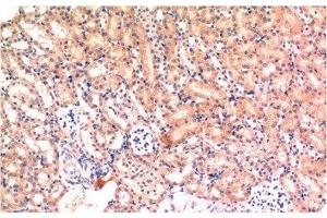 Immunohistochemistry of paraffin-embedded Mouse kidney tissue using Bax Monoclonal Antibody at dilution of 1:200. (BAX antibody)