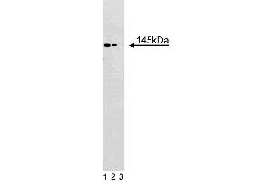 Western blot analysis of eps15 on a Jurkat lysate. (EPS15 antibody  (AA 694-888))
