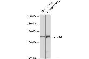 Western blot analysis of extracts of various cell lines using DAPK1 Polyclonal Antibody at dilution of 1:1000. (DAP Kinase 1 antibody)