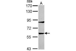 WB Image Sample (30 ug of whole cell lysate) A: IMR32 7. (Tyrosine Hydroxylase antibody)