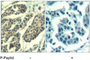Image no. 1 for anti-Cyclin B1 (CCNB1) (pSer147) antibody (ABIN401594) (Cyclin B1 antibody  (pSer147))