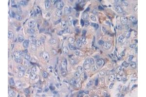 Immunohistochemistry (IHC) image for anti-Hypoxia Inducible Factor 1, alpha Subunit (Basic Helix-Loop-Helix Transcription Factor) (HIF1A) (AA 218-506) antibody (ABIN7439318)