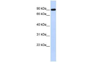 HECTD2 antibody used at 1 ug/ml to detect target protein. (HECTD2 antibody  (Middle Region))