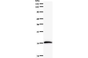 Western Blotting (WB) image for anti-Forkhead Box L2 (FOXL2) antibody (ABIN931144) (FOXL2 antibody)