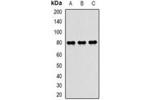 Western blot analysis of TAP2 expression in MCF7 (A), mouse spleen (B), mouse lung (C) whole cell lysates. (TAP2 antibody)
