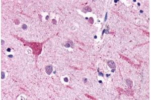 Anti-NPFFR2 antibody  ABIN1049116 IHC staining of human brain, neurons and glia. (NPFFR2 antibody  (Extracellular Domain))