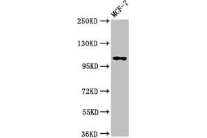 Western Blot Positive WB detected in: MCF-7 whole cell lysate All lanes: PSD antibody at 3. (PSD antibody  (AA 247-489))