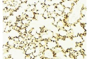 ABIN6272997 at 1/100 staining Mouse lung tissue by IHC-P. (ELAC2 antibody  (N-Term))
