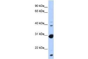 Western Blotting (WB) image for anti-Nuclear Receptor Subfamily 0, Group B, Member 2 (NR0B2) antibody (ABIN2458197)