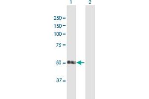 Western Blot analysis of SMAP1 expression in transfected 293T cell line by SMAP1 MaxPab polyclonal antibody. (SMAP1 antibody  (AA 1-440))