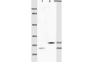 Lane 1: rat brain lysates Lane 2: human colon carcinoma lysates probed with Anti CPSF4/CPSF30 Polyclonal Antibody, Unconjugated (ABIN1386751) at 1:200 in 4 °C. (CPSF4 antibody  (AA 81-180))