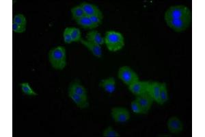 Immunofluorescence staining of HepG2 cells with ABIN7167795 at 1:200, counter-stained with DAPI. (Retinoic Acid Early Transcript 1E (RAET1E) (AA 31-225) antibody)