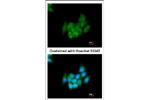 Immunofluorescence analysis of methanol-fixed HepG2, using Angiotensinogen antibody at 1:200 dilution.