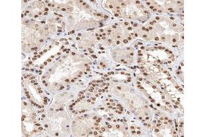 ABIN6267347 at 1/200 staining human kidney tissue sections by IHC-P. (Histone H2A antibody  (pThr121))