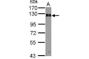 WB Image Sample (30 ug of whole cell lysate) A: A549 7. (Calpastatin antibody)