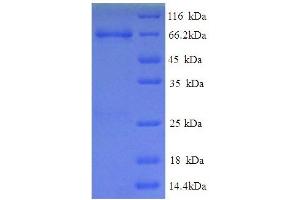 SDS-PAGE (SDS) image for Electron-Transferring-Flavoprotein Dehydrogenase (ETFDH) (AA 34-617) protein (His tag) (ABIN5713442)