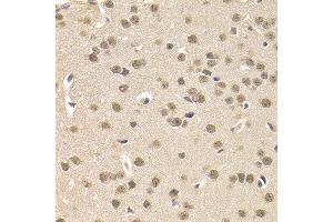 Immunohistochemistry of paraffin-embedded mouse brain using CSNK1E antibody at dilution of 1:200 (400x lens).