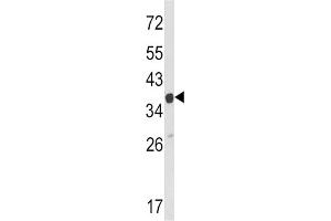Western Blotting (WB) image for anti-Actin Related Protein 2/3 Complex, Subunit 1A, 41kDa (ARPC1A) antibody (ABIN3002659) (ARPC1A antibody)