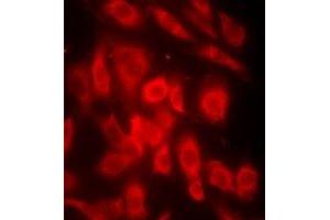 Immunofluorescent analysis of OMI staining in MCF7 cells. (HTRA2 antibody)