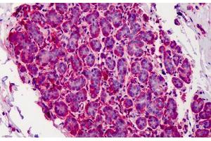 Human Breast: Formalin-Fixed, Paraffin-Embedded (FFPE) (CAPN1 antibody)