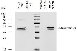 Western blotting analysis of human cytokeratin 19 using mouse monoclonal antibody A53-B/A2 on lysates of HT-29 cell line and MOLT-4 cell line (cytokeratin non-expressing cell line, negative control) under non-reducing and reducing conditions. (Cytokeratin 19 antibody  (Biotin))