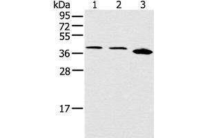 Western blot analysis of Jurkat Hela and 231 cell using CCNG1 Polyclonal Antibody at dilution of 1:400 (Cyclin G1 antibody)