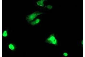 Image no. 3 for anti-T-Cell Acute Lymphocytic Leukemia 1 (TAL1) antibody (ABIN1501288) (TAL1 antibody)