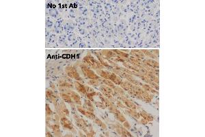 Immunohistochemistry (IHC) image for anti-Cadherin 1, Type 1, E-Cadherin (Epithelial) (CDH1) antibody (ABIN6254215)