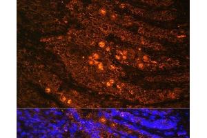 Immunofluorescence analysis of Rat Intestine using TLN1 Polyclonal Antibody at dilution of 1:100. (TLN1 antibody)