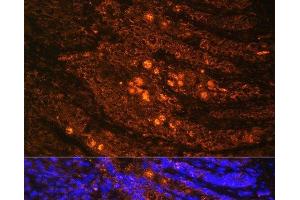 Immunofluorescence analysis of Rat Intestine using TLN1 Polyclonal Antibody at dilution of 1:100. (TLN1 antibody)