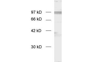 dilution: 1 : 1000, sample: enriched synaptosomal membranes (APP antibody  (C-Term))