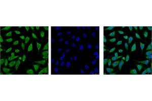 Immunofluorescence (IF) analysis of HeLa with antibody (Left) and DAPI (Right) diluted at 1:100. (HSP70 antibody)