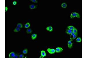 Immunofluorescent analysis of A431 cells using ABIN7168723 at dilution of 1:100 and Alexa Fluor 488-congugated AffiniPure Goat Anti-Rabbit IgG(H+L) (SCAMP2 antibody  (AA 1-153))