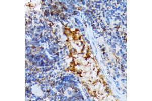 Immunohistochemistry of paraffin-embedded mouse spleen using T Rabbit mAb (ABIN7270916) at dilution of 1:100 (40x lens). (TACC3 antibody)