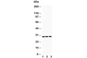 Western blot testing of ATF1 antibody and Lane 1:  rat spleen (AFT1 antibody  (AA 1-271))