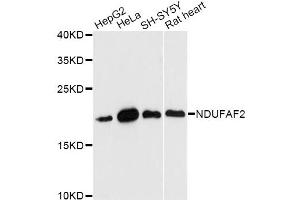 Western blot analysis of extracts of various cell lines, using NDUFAF2 antibody (ABIN6293812) at 1:3000 dilution. (NDUFAF2 antibody)
