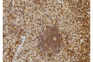 ABIN6277651 at 1/100 staining Rat spleen tissue by IHC-P. (MTR4 antibody  (Internal Region))