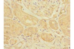 Immunohistochemistry of paraffin-embedded human kidney tissue using ABIN7152170 at dilution of 1:100 (EIF3K antibody  (AA 1-218))