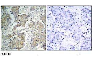 Image no. 3 for anti-VEGF Receptor 2 (VEGFR2) (pTyr1214) antibody (ABIN196769) (VEGFR2/CD309 antibody  (pTyr1214))