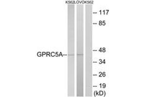 Western blot analysis of extracts from K562/LOVO cells, using GPRC5A Antibody. (GPRC5A antibody  (AA 140-189))