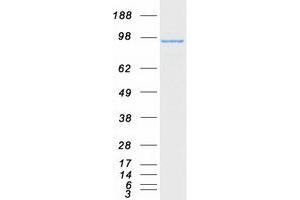 Western Blotting (WB) image for FYVE, RhoGEF and PH Domain Containing 4 (FGD4) protein (Myc-DYKDDDDK Tag) (ABIN2721030)