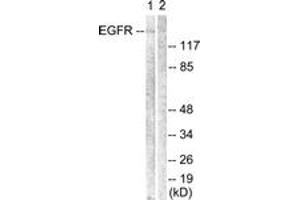 Western blot analysis of extracts from Jurkat cells, using EGFR (Ab-1069) Antibody. (EGFR antibody  (AA 1031-1080))