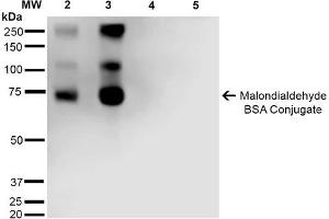 Western Blot analysis of Malondialdehyde-BSA Conjugate showing detection of 67 kDa Malondialdehyde -BSA using Mouse Anti-Malondialdehyde Monoclonal Antibody, Clone 11E3 . (Malondialdehyde antibody  (FITC))